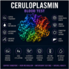 ceruloplasmin test copper overload free copper metallothionein