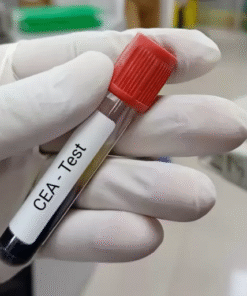 CEA