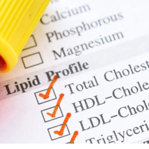 Lipid Panel