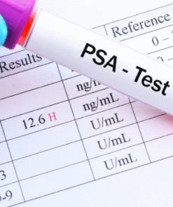 PSA, Serum