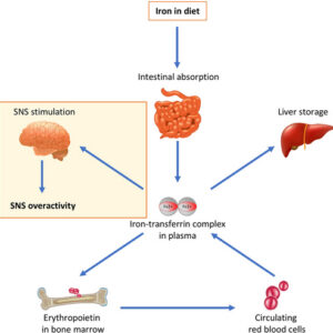 iron overload leaky gut hypertension inflammation