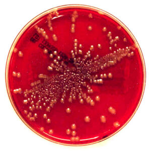 Urine Culture, Routine