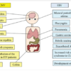 epstein barr virus symptoms