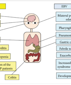 epstein barr virus symptoms