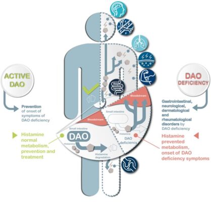 inflammation dao levels