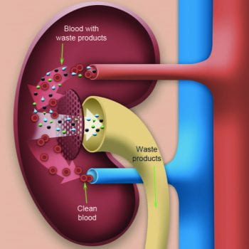 kidney.detoxification sodium bicarbonate improve methylation sodium bicarbonate raise pH improve methylation improve SAH