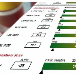 cholesterol myth. labcorp cholesterol tests oxidized ldl and hdl