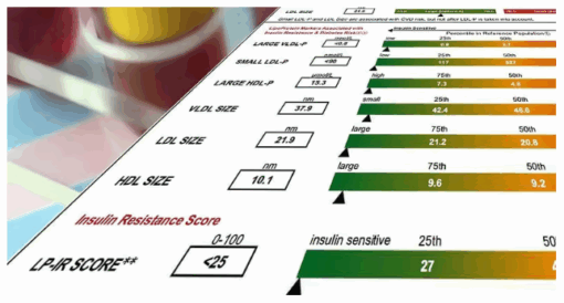 cholesterol myth. labcorp cholesterol tests oxidized ldl and hdl
