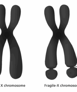 fragile x syndrom testing online