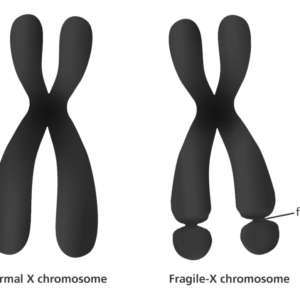 fragile x syndrom testing online