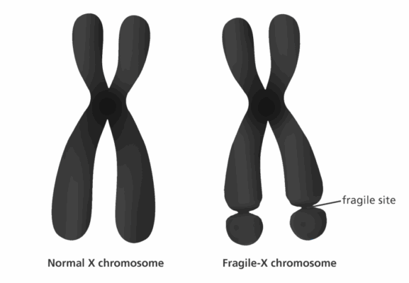 fragile x syndrom testing online