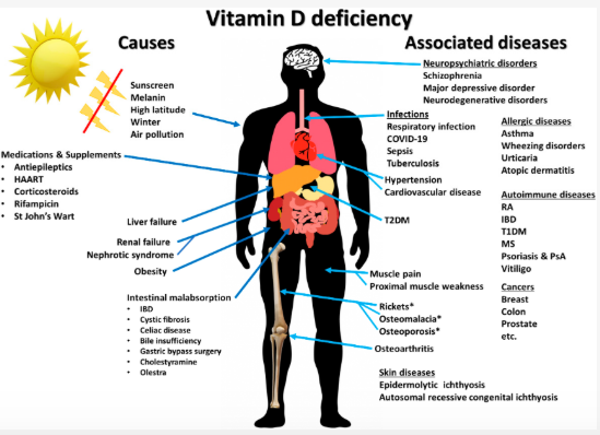 vitamin d therapy interview