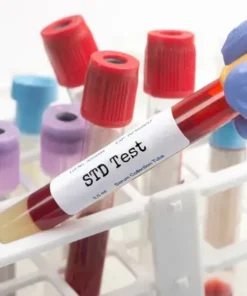 Comprehensive STD Screening Panel