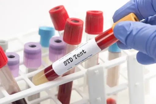 Comprehensive STD Screening Panel | Second Opinion Physician