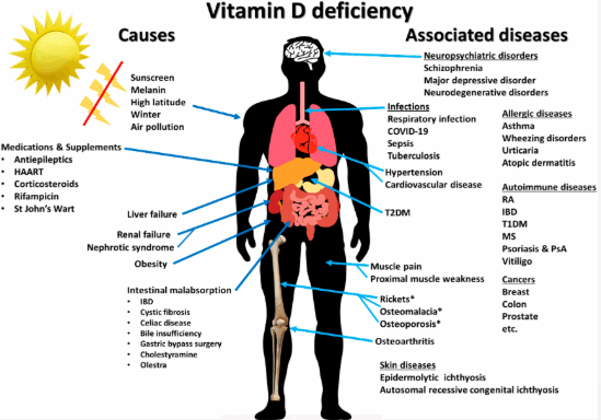 vitamin d therapy interview